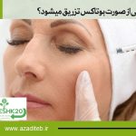 در چه نقاطی از صورت بوتاکس تزریق میشود؟