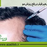 اثرات تزریق هیر فیلر در رفع ریزش مو