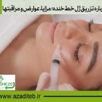 همه چیز درباره تزریق ژل خط خنده