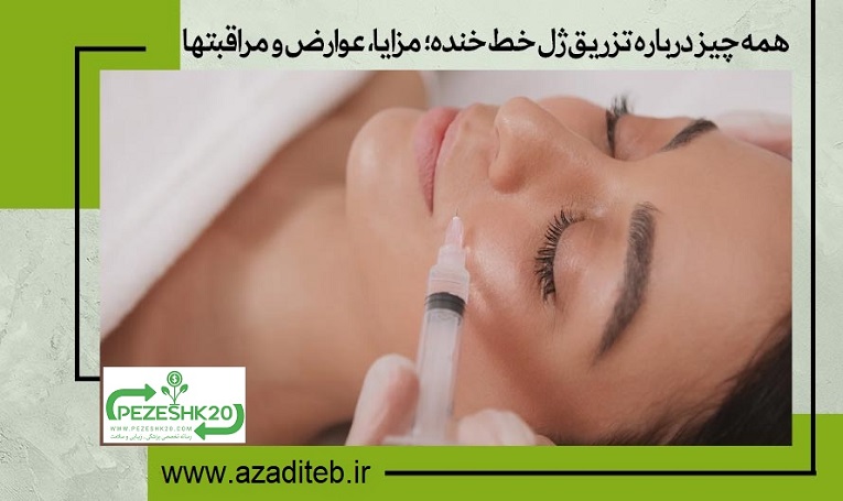 همه چیز درباره تزریق ژل خط خنده