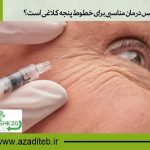 آیا تزریق بوتاکس درمان مناسبی برای خطوط پنجه کلاغی است؟